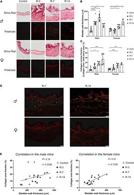 The Release of 24 h Infravesical Obstruction in Mice: Changes in Molecular, Morphological, and Functional Parameters for 14-Day Observation